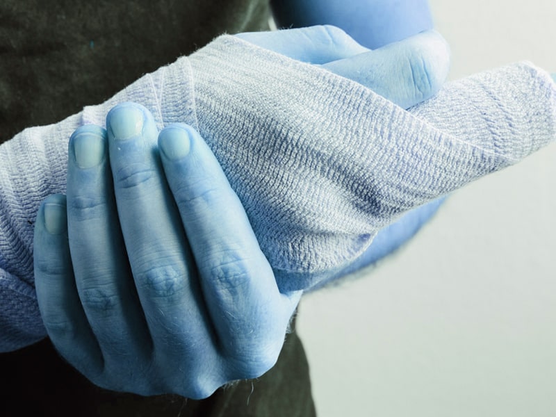 手湿疹への心ないことばと無理解